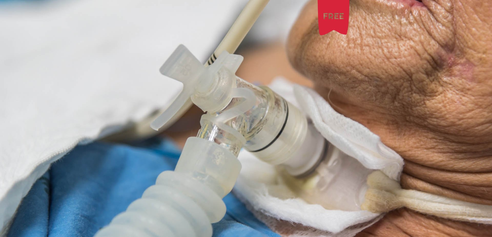 Interveno em enfermagem na pessoa com ostomia respiratria: estomaterapia 