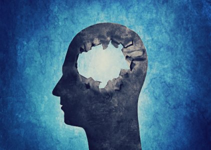 Alzheimer: Tcnica no-invasiva pode restaurar memria