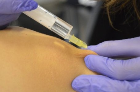 Mesoterapia no rejuvenescimento facial