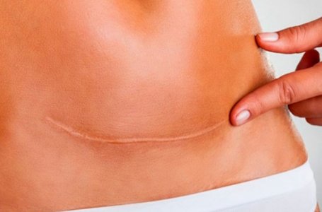 Terapia Manual em Cicatrizes - Workshop Pr-Congresso Dermatis 2025