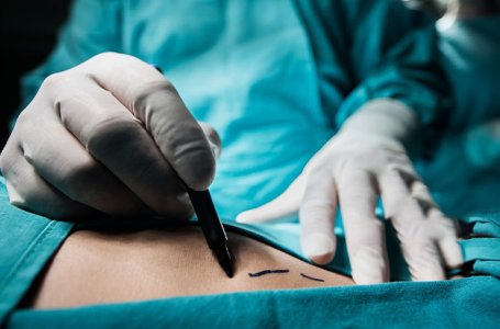 Complicaes de Cirurgia Plstica e Fisioterapia Dermatofuncional - Workshop Pr-Congresso Dermatis 2025